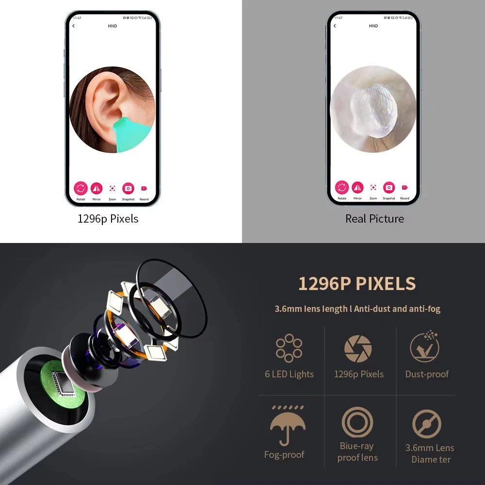 Smart Visual Ear Cleaner – 1296P Camera with WiFi & LED Lights